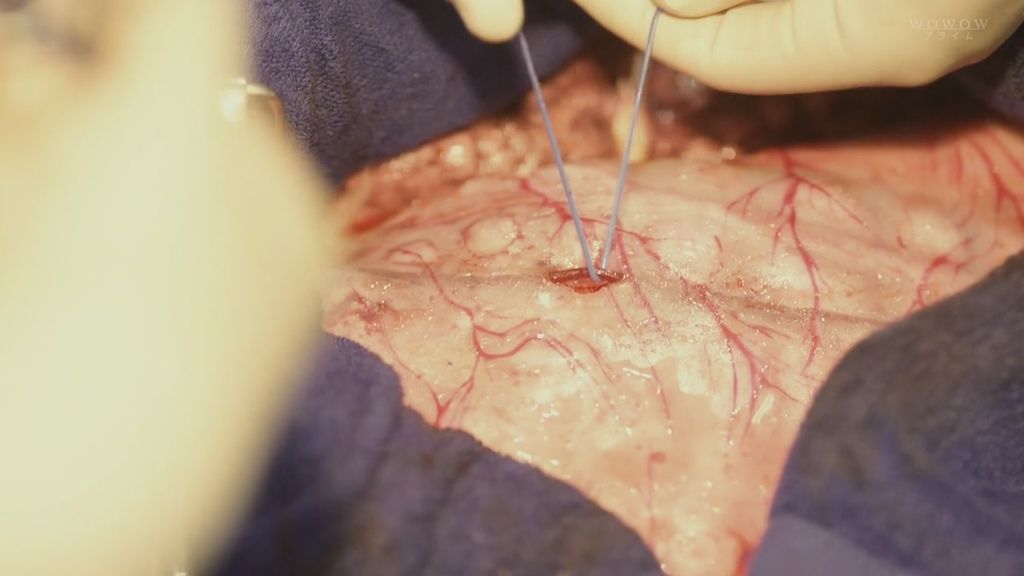 孤高的手術刀ep1 (3).JPG 孤高的手術刀ep1 (3).JPG