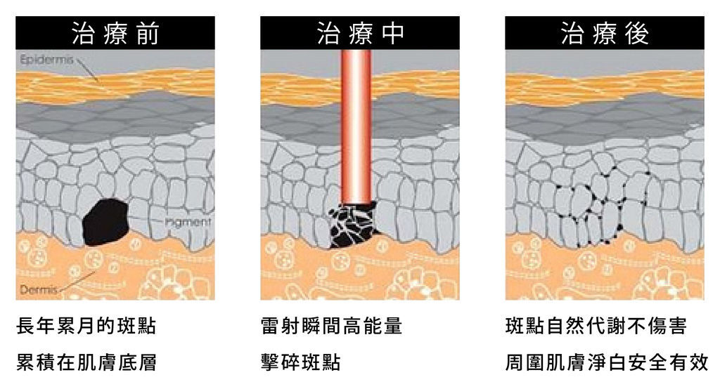 超皮苗-04.jpg