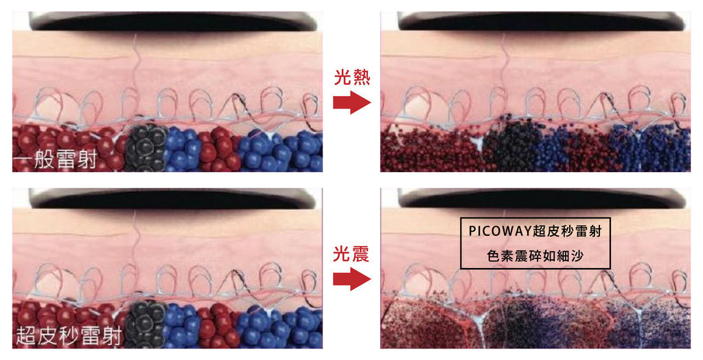 超皮苗-08.jpg 超皮苗-08.jpg