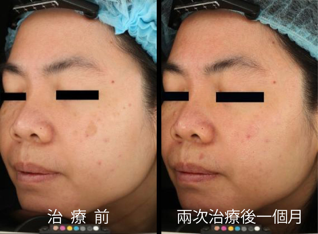 超皮苗-15.jpg 超皮苗-15.jpg