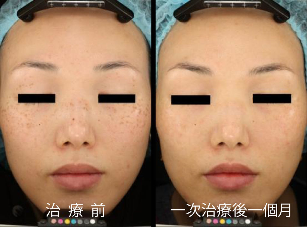 超皮苗-14.jpg 超皮苗-14.jpg