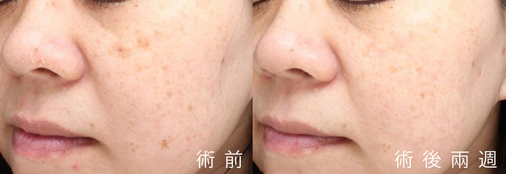 超皮苗-11.jpg 超皮苗-11.jpg