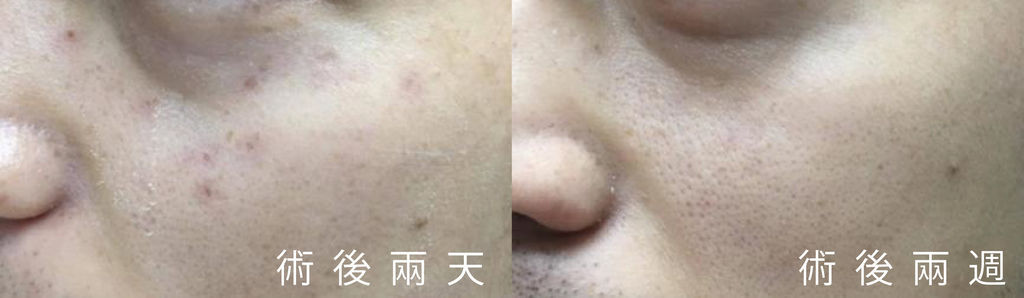 超皮苗-13.jpg 超皮苗-13.jpg