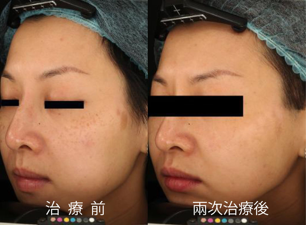 超皮苗-16.jpg 超皮苗-16.jpg