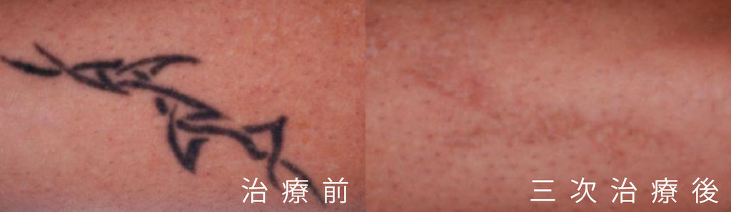 超皮苗-18.jpg 超皮苗-18.jpg