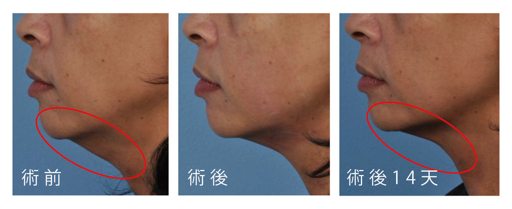 音波-03.jpg 音波-03.jpg