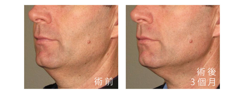 音波-06.jpg 音波-06.jpg