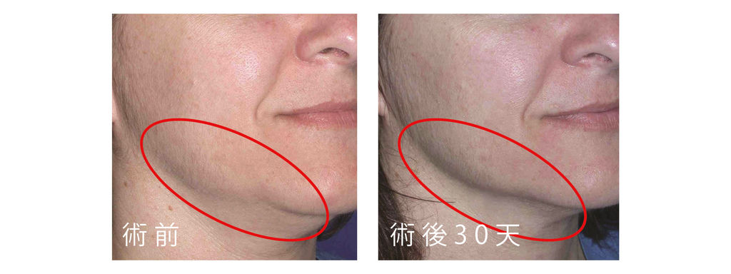 音波-04.jpg 音波-04.jpg