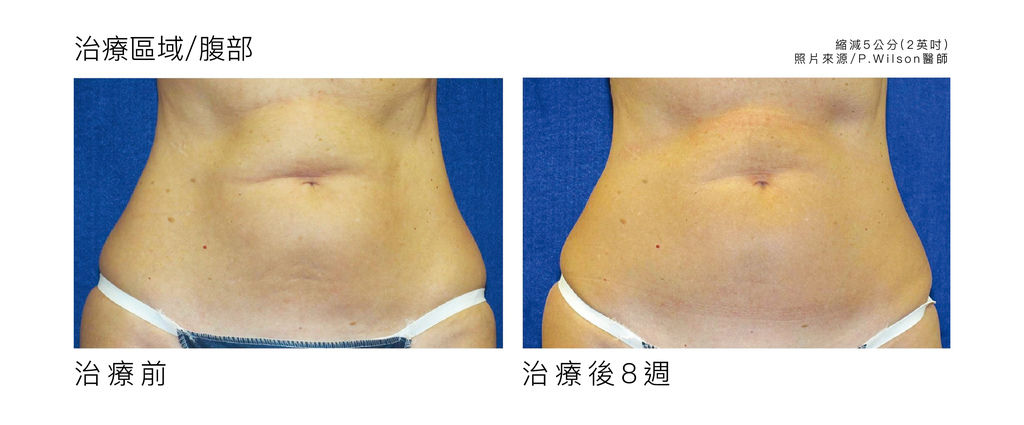 立塑-04.jpg 立塑-04.jpg