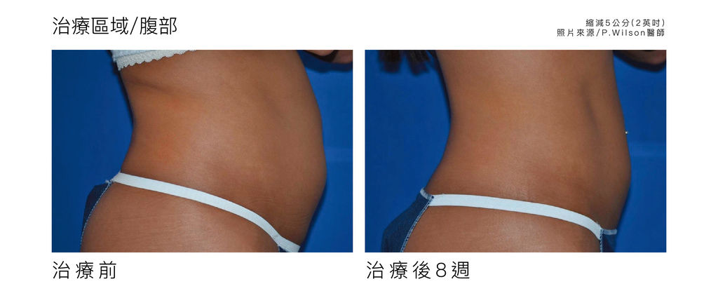 立塑-03.jpg 立塑-03.jpg