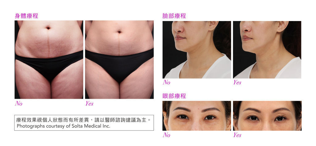 鳳凰電波-05.jpg 鳳凰電波-05.jpg