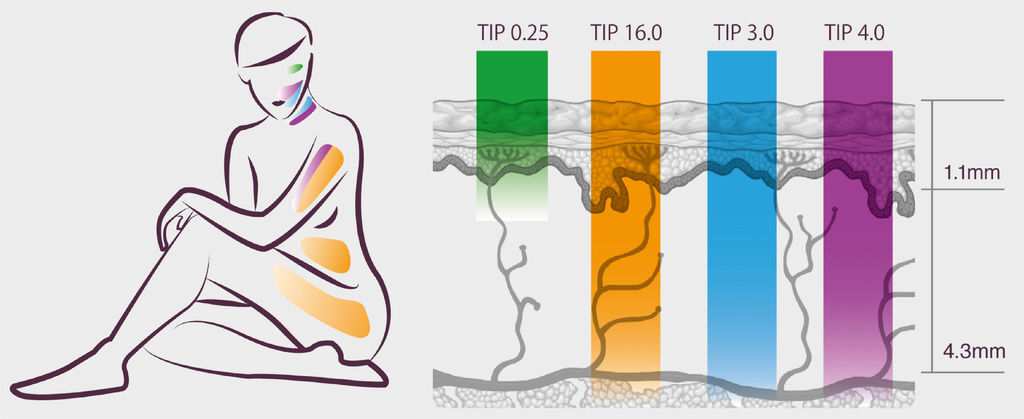 鳳凰電波-06.jpg 鳳凰電波-06.jpg