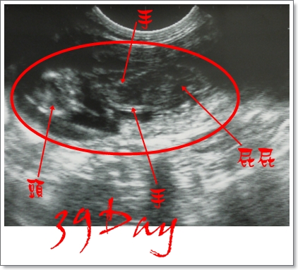 39天超音波