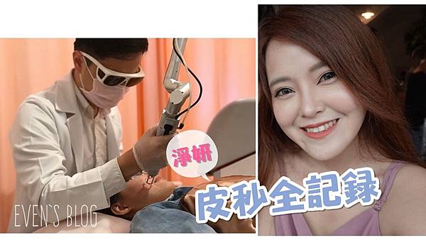 【醫美】回來淨妍診所保養啦~皮秒雷射跟小斑抗戰!打完膚色均勻,皮膚超透亮♥
