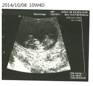 10W4D