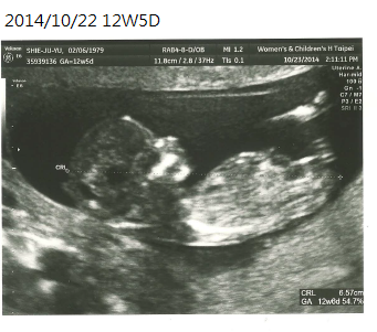 12W5D