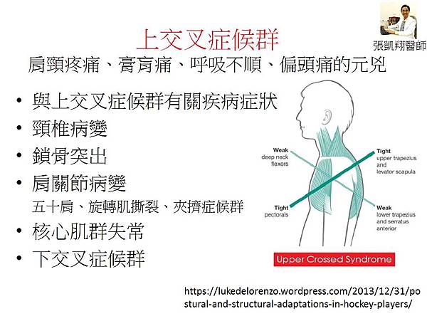 upper crossed syndrome3.jpg