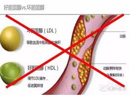 「美國政府修改了40年以來的錯誤：膽固醇有益無害，不再分好壞」的圖片搜尋結果