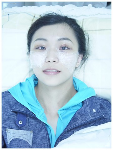 台中醫美,台中醫美推薦,台中醫美診所推薦,音波拉皮,電波拉皮,音波拉提,SMAS超聲刀,飛梭雷射,淨膚雷射,無痛雷射除毛,CO2飛梭雷射, HeNe雷射,杏仁酸換膚,SPA,無痛除毛,台中醫美揚昇診所,台中揚昇診所,揚昇診所醫美課程,揚昇診所醫美評價,揚昇診所醫美價錢 台中玻尿酸推薦11