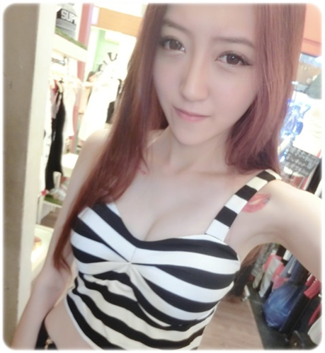 台中醫美推薦玻尿酸填補淚溝