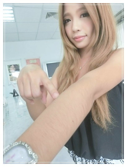 雷射除毛5 雷射除毛5