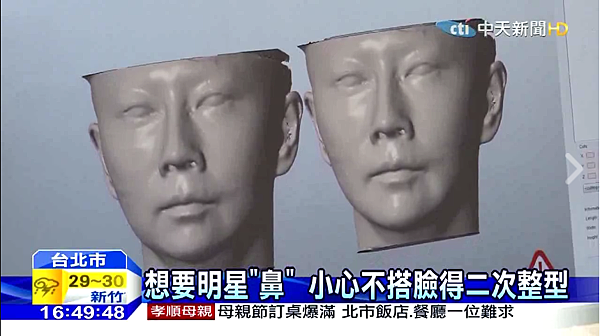 3D設計鼻雕手術-中天採訪.png