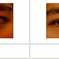 雙眼皮案例 - 10.jpg