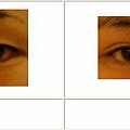 雙眼皮案例 - 8.jpg