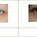 雙眼皮案例 - 16.jpg