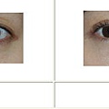 雙眼皮案例 - 14.jpg