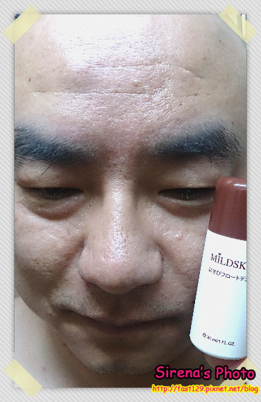 MILDSKIN 第三代巧克力粉刺面膜組