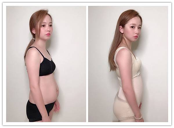 前後對比.1.jpg 塑身衣