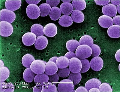 Scanning electron micrograph of S. aureus; false color added Photo Credit: Janice Haney Carr – This media comes from the Centers for Disease Control and Prevention‘s Public Health Image Library (PHIL)