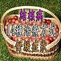 結核病14種治療方式舒緩症狀