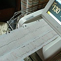 Baby pulse record / 上面是胎兒心跳，下面是陣痛頻率，還不規律...