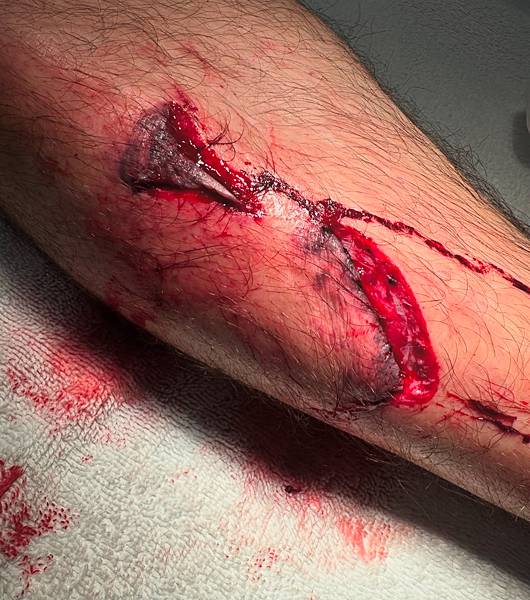 〈寫在 UFC 311 Co-Main Event 賽後:M