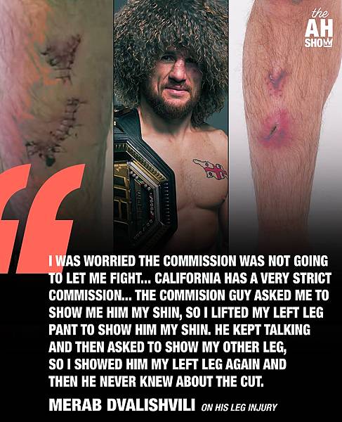 〈寫在 UFC 311 Co-Main Event 賽後:M