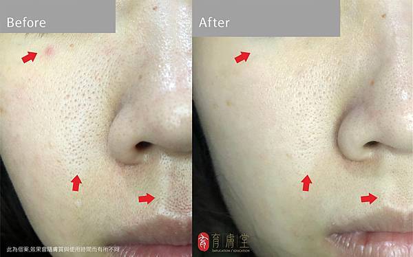 豆仔使用前後.jpg 豆仔使用前後.jpg