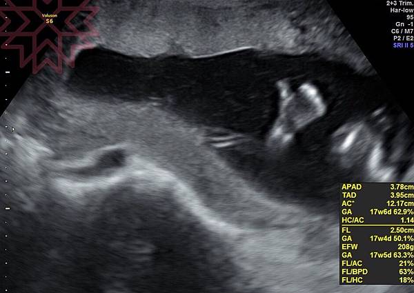 FullSizeRender.jpg FullSizeRender.jpg