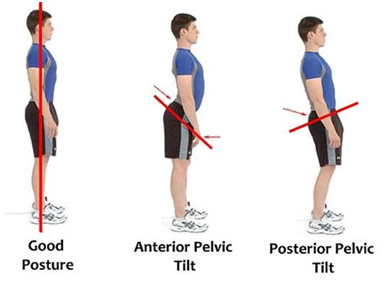 Reasons for tight hamstrings