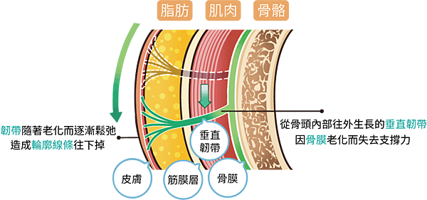 韌帶老化鬆弛而造成輪廓線往下掉D-1030x481