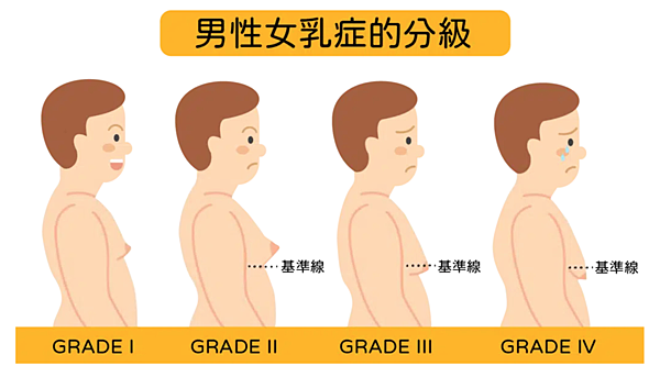 4D胸廓塑型術-粹究美學-1