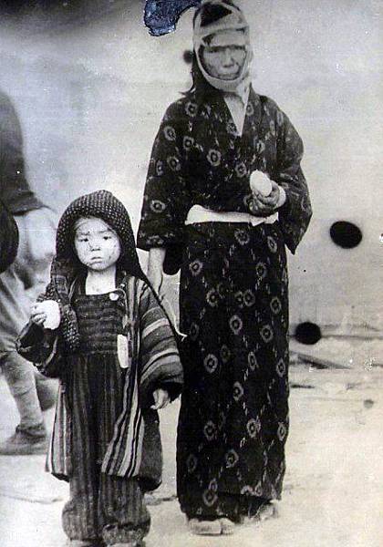(圖四)裹著血跡斑斑的繃帶,家庭留念照.jpg