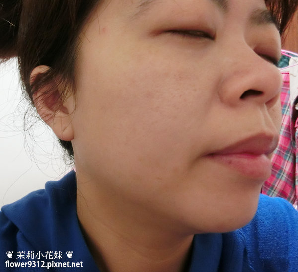 D.AZ 愛德愛麗 醫美術後敏感肌活膚修護組 (21).JPG