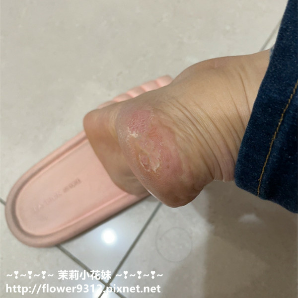 醫生推薦保濕 Vanicream 薇霓肌本 乾敏肌 秋冬換季必備 無添加保養 (12).JPG