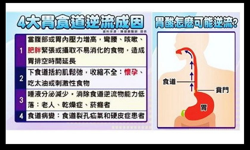 胃酸不足 胃酸不足治疗 胃酸不足的症状 胃酸反流知乎 胃酸不足 胃酸不足治疗 胃酸不足的症状 胃酸反流知乎