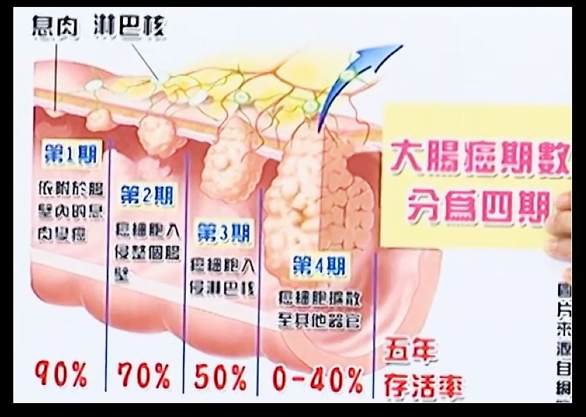 大腸