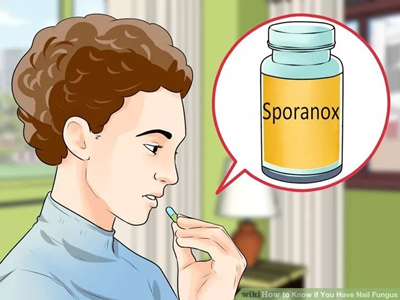 口服抗真菌药物.jpg 口服抗真菌药物.jpg