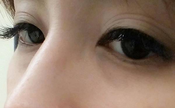 多層雙眼皮 多層雙眼皮