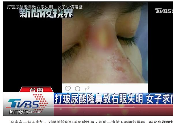 螢幕快照 2017-02-21 下午12.17.33.png 螢幕快照 2017-02-21 下午12.17.33.png